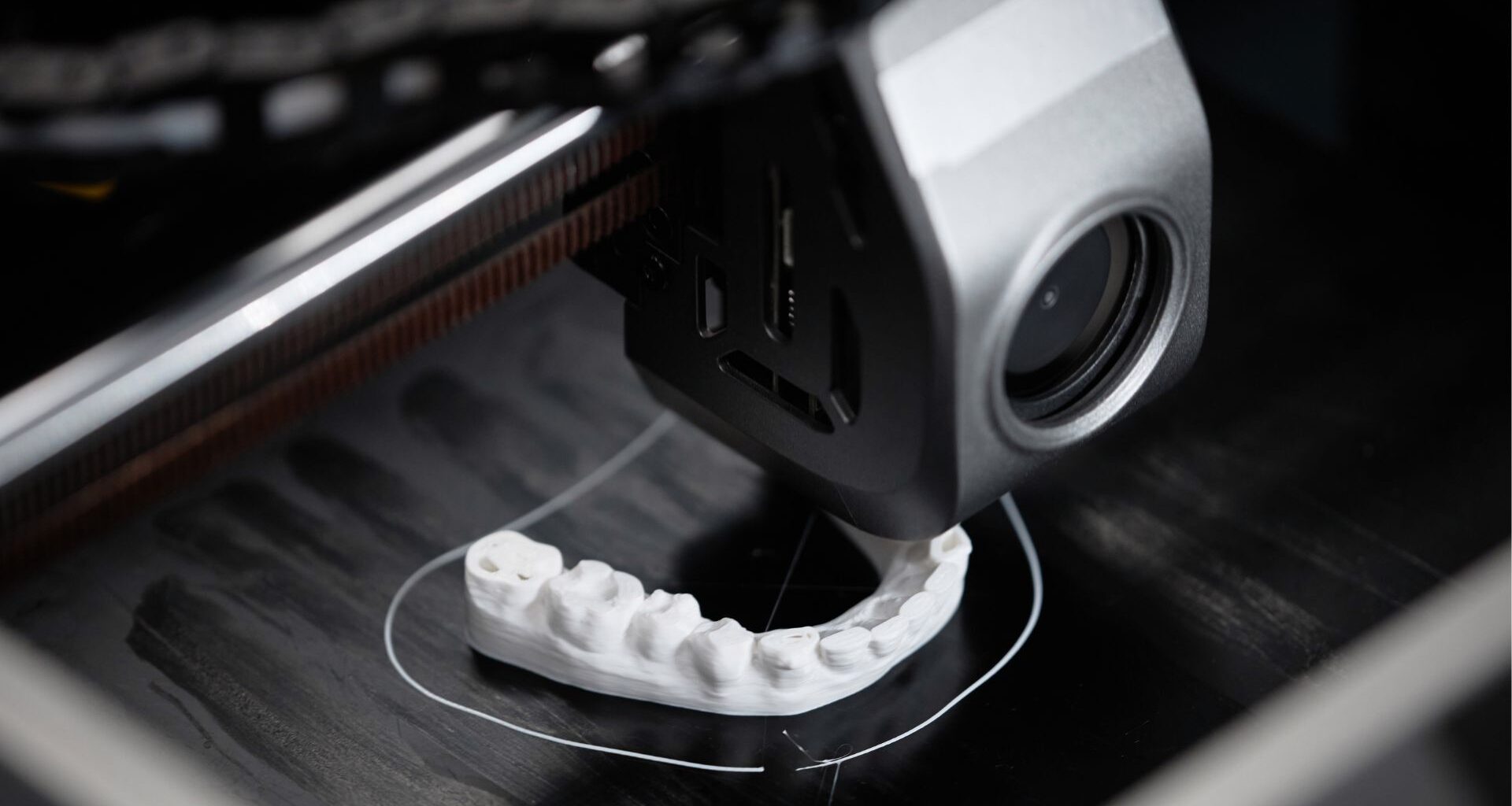 stampante 3d dentale