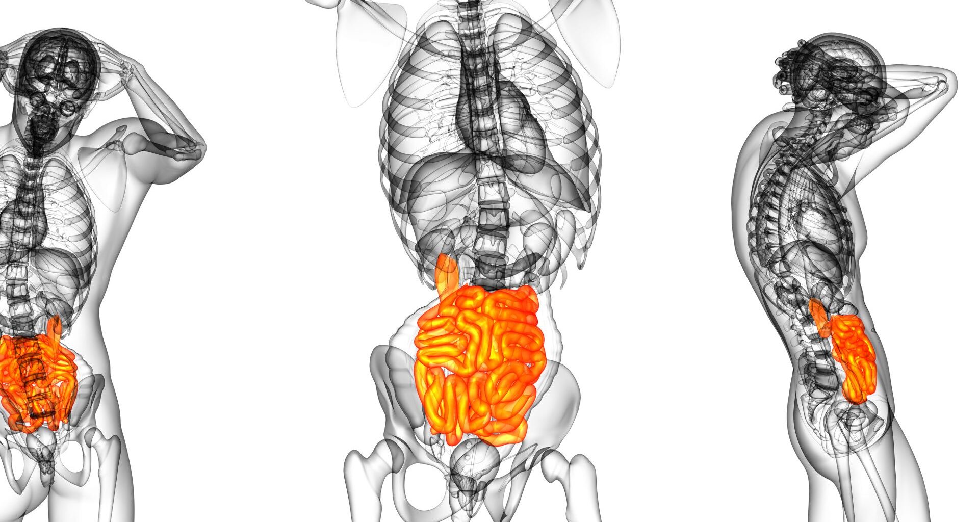 intestino e cervello