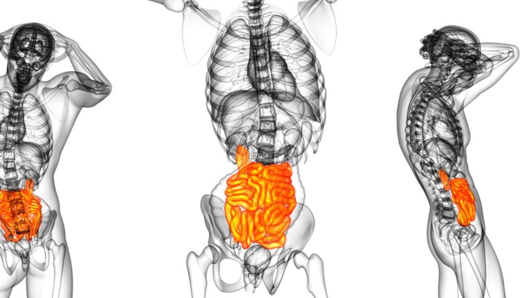intestino e cervello