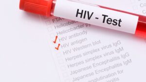 Quali nuovi farmaci per l'HIV saranno sul mercato italiano entro il 2025